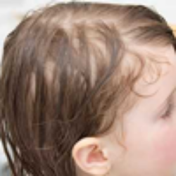 تصویر برای دسته  نازک و کم حجم