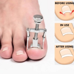 تصویر برای دسته  ارتودنسی ناخن